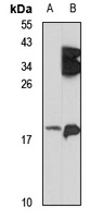 NRN1L Rabbit Polyclonal Antibody