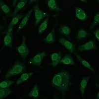 NUP214 Rabbit Polyclonal Antibody