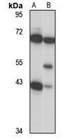 NUP43 Rabbit Polyclonal Antibody