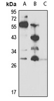 Oncostatin M Rabbit Polyclonal Antibody