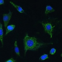 Oncostatin M Rabbit Polyclonal Antibody