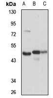 OXSM Rabbit Polyclonal Antibody