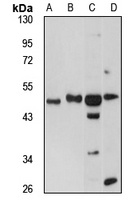 P2Y12 Rabbit Polyclonal Antibody