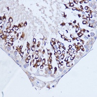 PABPC1 Rabbit Polyclonal Antibody