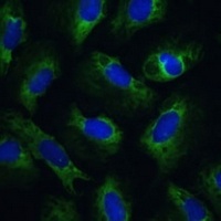 PABPC1 Rabbit Polyclonal Antibody
