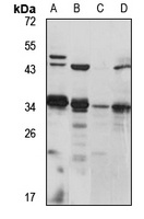 PACRG Rabbit Polyclonal Antibody