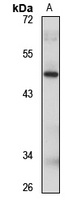 PACSIN1 Rabbit Polyclonal Antibody