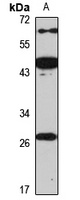 PAFAH1B3 Rabbit Polyclonal Antibody