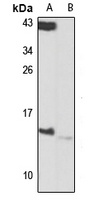 Magmas Rabbit Polyclonal Antibody