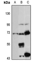 PAPSS1 Rabbit Polyclonal Antibody