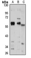 PDCD7 Rabbit Polyclonal Antibody