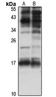 Perp Rabbit Polyclonal Antibody