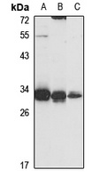 PGAM5 Rabbit Polyclonal Antibody
