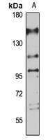 PHF20 Rabbit Polyclonal Antibody