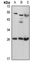 PID1 Rabbit Polyclonal Antibody