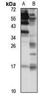 PLA2G12A Rabbit Polyclonal Antibody