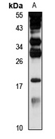 PLA2G16 Rabbit Polyclonal Antibody