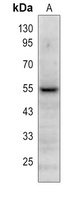 PLA2G7 Rabbit Polyclonal Antibody