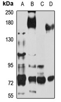 Plexin-B2 Rabbit Polyclonal Antibody