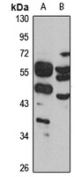PNKD Rabbit Polyclonal Antibody