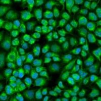 PNKD Rabbit Polyclonal Antibody