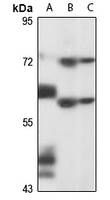 PNLDC1 Rabbit Polyclonal Antibody