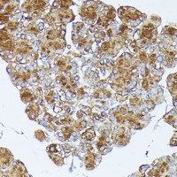 PLRP1 Rabbit Polyclonal Antibody