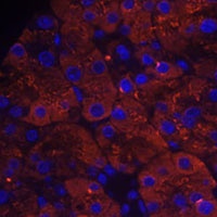 PLRP1 Rabbit Polyclonal Antibody