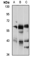 AMPK alpha 1/2 Rabbit Polyclonal Antibody
