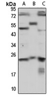 PRKRIP1 Rabbit Polyclonal Antibody