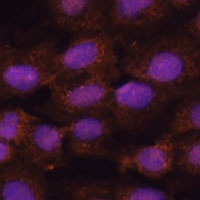 PRKRIP1 Rabbit Polyclonal Antibody