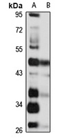 GPR73b Rabbit Polyclonal Antibody