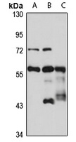 PRPF31 Rabbit Polyclonal Antibody