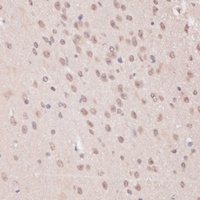 PRPF31 Rabbit Polyclonal Antibody