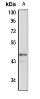PRR5 Rabbit Polyclonal Antibody