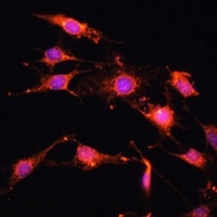 PRR5 Rabbit Polyclonal Antibody
