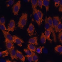 Periaxin Rabbit Polyclonal Antibody