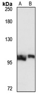 PSMD1 Rabbit Polyclonal Antibody