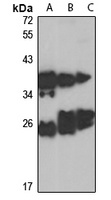 RAB5B Rabbit Polyclonal Antibody