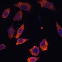 RAB5B Rabbit Polyclonal Antibody