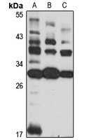 Dexras1 Rabbit Polyclonal Antibody