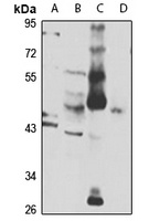 FOX1A Rabbit Polyclonal Antibody