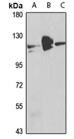 RBM15 Rabbit Polyclonal Antibody