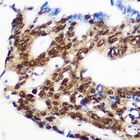 RBM15 Rabbit Polyclonal Antibody