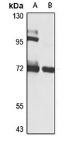 RBM15B Rabbit Polyclonal Antibody