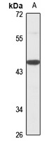 RCCD1 Rabbit Polyclonal Antibody