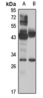 Pirh2 Rabbit Polyclonal Antibody