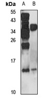 RELM beta Rabbit Polyclonal Antibody