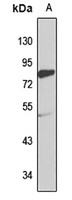 RHOT2 Rabbit Polyclonal Antibody