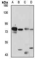 RSK3 Rabbit Polyclonal Antibody